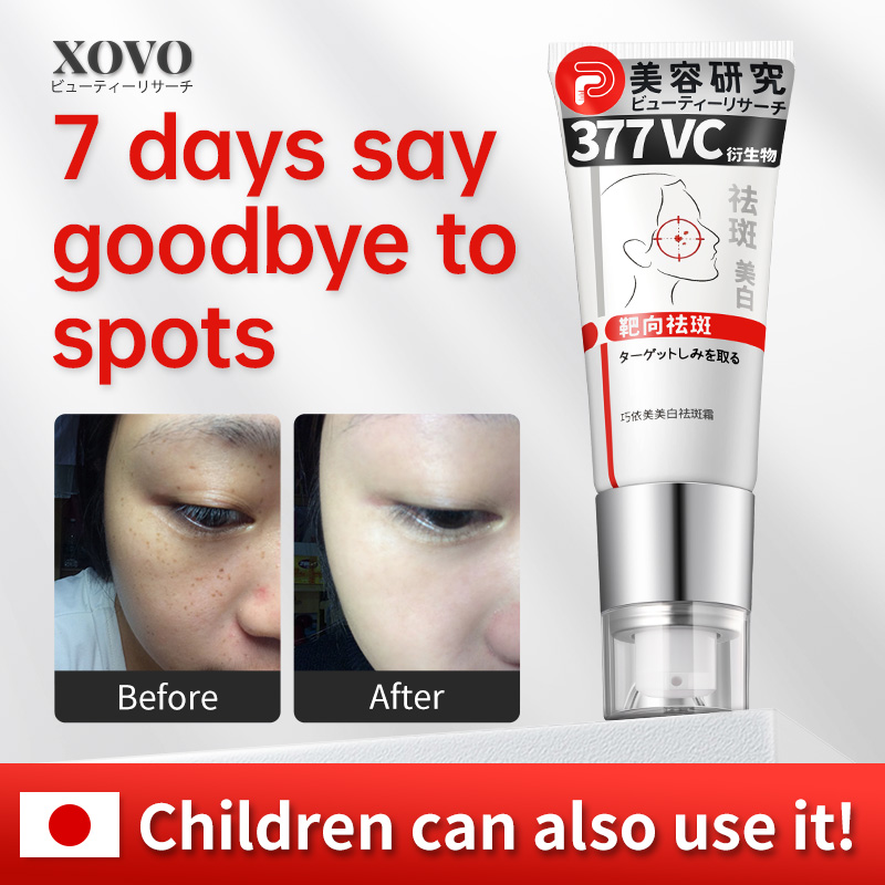 ??Hot in Japan?? Freckle Removal Facial Moisturizers Freckle Cream Blackhead Removal Whitening Skin Care Removing Age Dark Spots Balance Pigments Improve Skin Texture Smooth Wrinkle 40g 祛斑霜