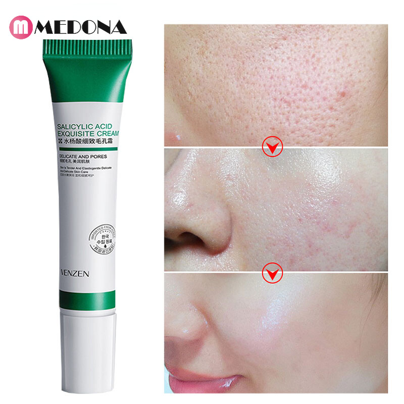 [Medona] 20ml Salicylic Acid Cream Whitening Cream Shrink Pores Improve Acne Blackheads Anti Aging Oil Control Skin Care